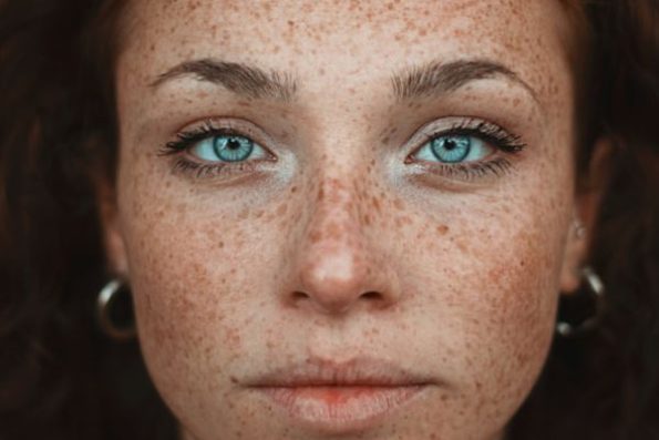 Model with faux freckles – a sun-kissed and playful trend for 2025, Makeup trends 2025